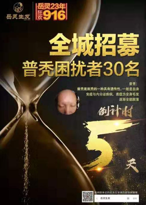 全城招募普禿困擾者30名!0元體驗(yàn)